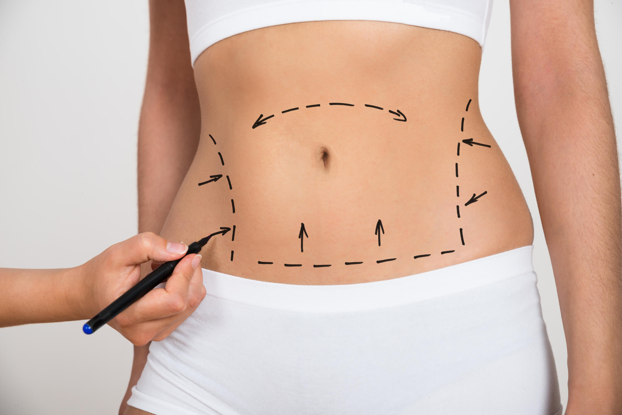 Person Hand Drawing Lines On A Woman's Abdomen