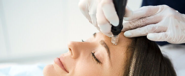 woman microneedling her eyebrows by professional